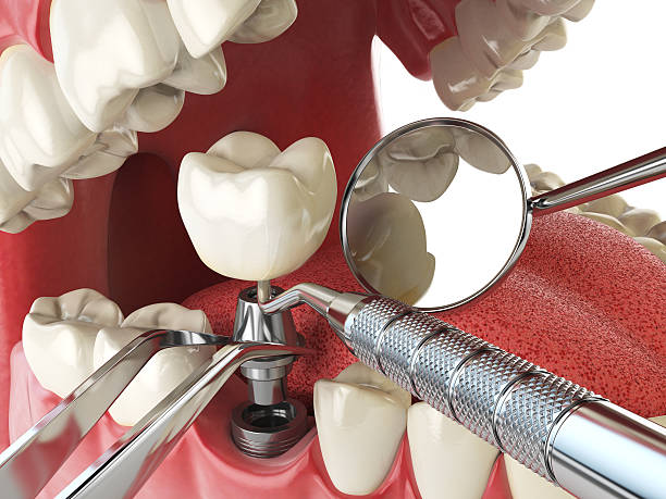 Best Weekend Emergency Dentist in Duenweg, MO